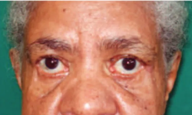 Figure 3 – Final postoperative appearance.