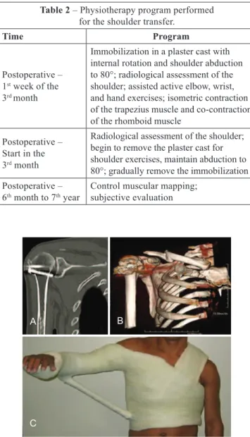 Figure 5 –In A, computed tomography examination. In  B , three-dimensional reconstruction