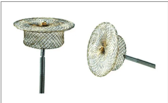 Figure 1 – Two details of the Cera TM  PDA Occluder. The retention disc  can be observed in the aortic extremity and the thread in the opposed  extremity connected to the releaser cable
