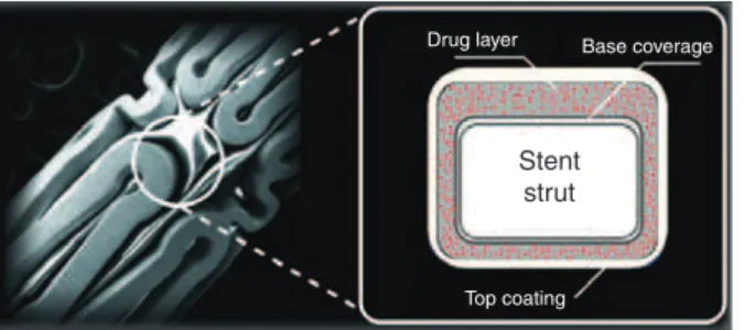 Figure 1 – Sirolimus-eluting Firebird ®  stent (left), including schematic  representation of the drug-polymer layers and the metal strut level (right)