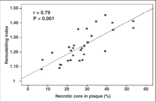 Figure 3 – Graphical representation of the percentage of necrotic  core along the atheromatous plaque, according to the cross­section.