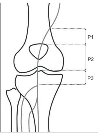 Figure 4 – Schematic representation of the popliteal artery segments. 