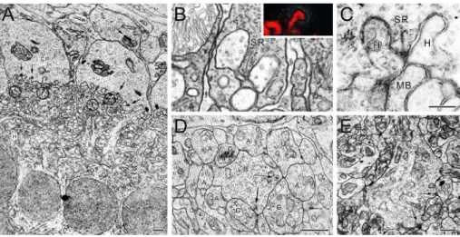 Figure 2. Synaptic organization of the plexiform layers. (A) Low-power electron micrograph of the human outer plexiform layer