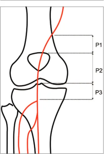 Figure 1 – Schematic representation of the segments of popliteal artery. 