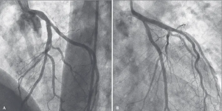 Figure 3 – Angiographic control seven months post-intervention.