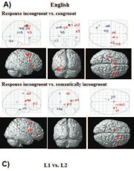 Table 2 presents the main areas of activation  differences between the groups when the Stroop task was  performed in English (i.e., sole language for monolinguals  and L2 for bilinguals) along with the corresponding  Talairach coordinates and matching Brod