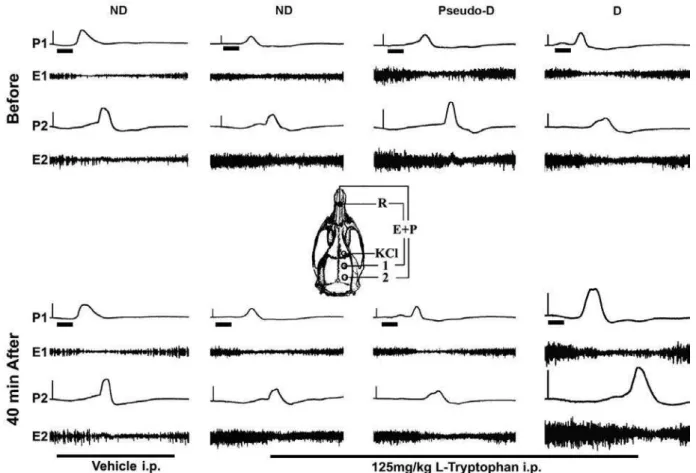 Figure 1. Examples of CSD recordings in REM sleep deprived (D), pseudo-deprived (Pseudo), and non-deprived (ND) rats