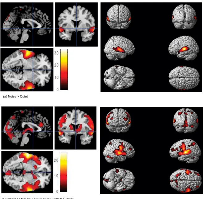 Figure 1. Statistical parametric maps (SPMs) obtain from group analysis (n = 15,  p&lt; 0.05) showing brain activation associated  with (a) N &gt; Q, (b) WMQ &gt; Q and (c) WMN &gt; Q, overlaid onto structural brain images, shown for transverse, sagittal, 