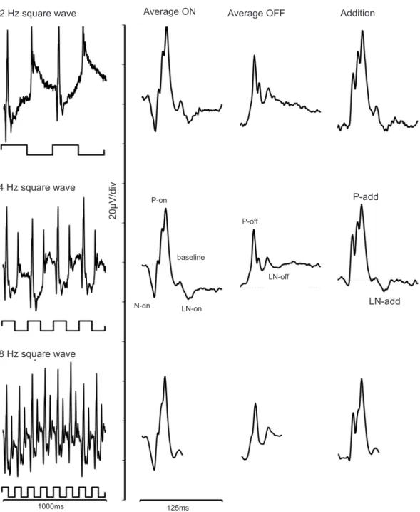 Figure 1. Examples of full-ield ERGs elicited by square wave stimuli at 2 Hz (top), 4 Hz (middle) and 8 Hz (bottom)