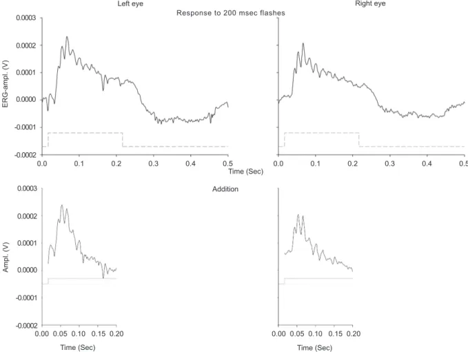 Figure 7: An example of the technique of addition of rapid-on and rapid-off responses to a 200 msec pulse of light measured  in the two eyes of a C57/BL6 mouse