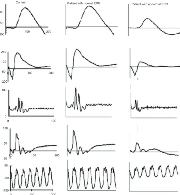 Figure 3. Individual full-ield electroretinographic recordings. Left column shows the responses of a control subject