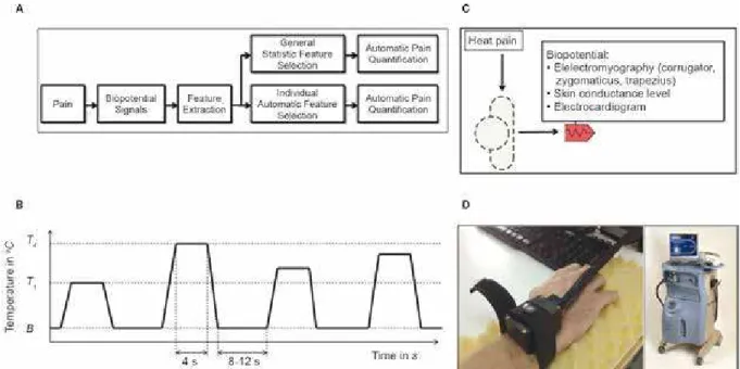 Figure 1. (A) Study procedure. (B) Heat signal with baseline (B) vs. pain thresholds (T 1 , T 4,  T 2 , and T 3 , from left to right)