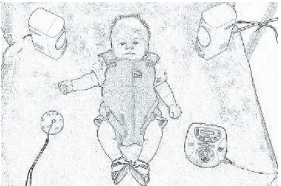 FIGURE 2. Infant in the  P1 position.