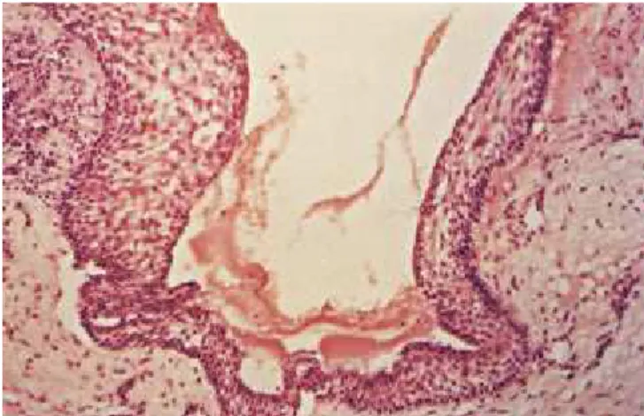 FIGURE 6 - Area of tran si ti on from the re du ced ena mel epit he li um to the stra ti fi ed squa mous epit he li um