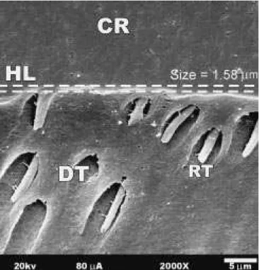 FIGURE 3 - Photomicrograph of the resin-dentin inter- inter-face formed by Etch &amp; Prime 3.0
