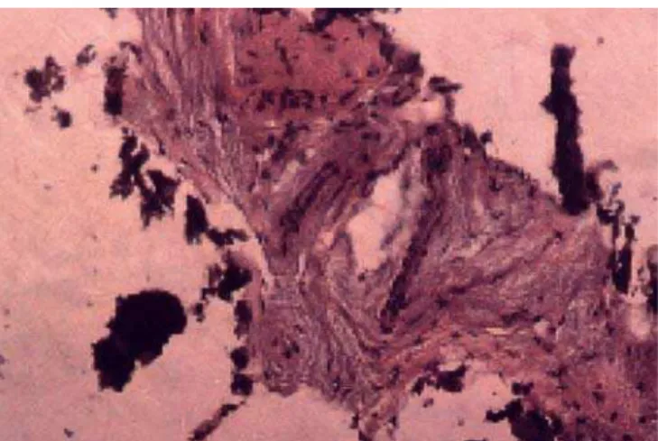 FIGURE 9 - At 6 months, haversian remodeling started within the compact cortical layer (acid fuchsin, 160 X).