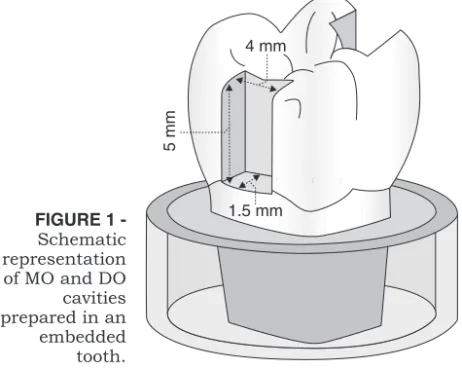 FIGURE 1 - -Schematic representation of MO and DO cavities prepared in an embedded tooth.