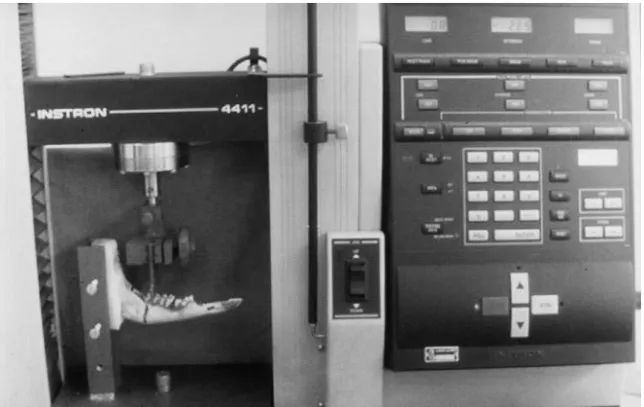 FIGURE 1 - Instron Ò machine during the experimental study.