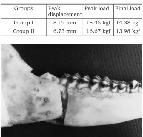 FIGURE 2 - Bend of distal segment, by absorbable screw
