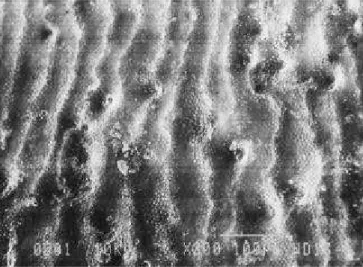 Fig ures 1 through 6 show the ef fects of some of the pro phy lac tic treat ments em ployed.