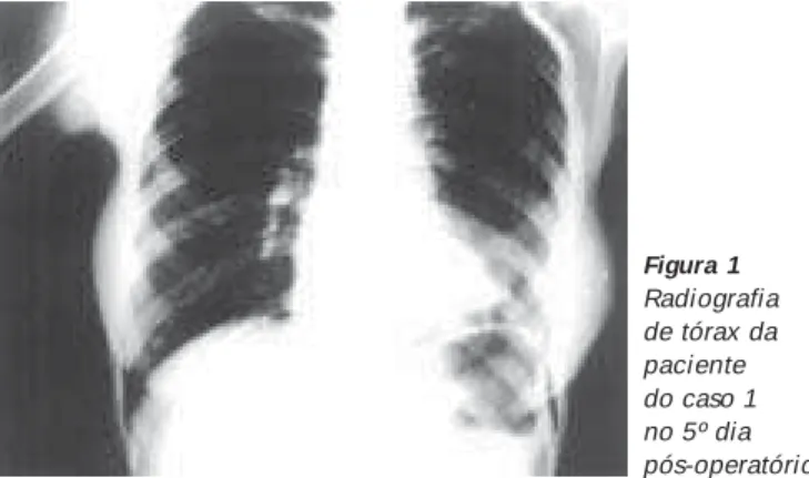 Figura 1 Radiografia de tórax da paciente do caso 1 no 5º dia pós-operatório