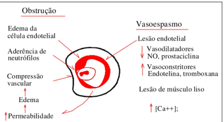 Figura 3 – Fatores que contribuem para a disfunção da microcircula- microcircula-ção na lesão por isquemia-reperfusão