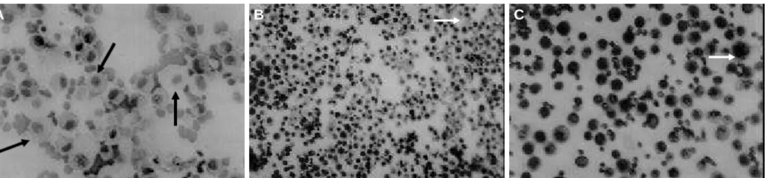 Figura 2 – Microscopia óptica de lavado bronco-alveolar de rato tratado com amiodarona