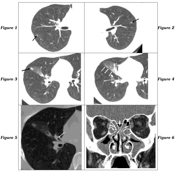 Figure 1  Figure 2 