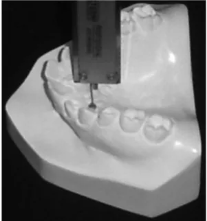 Figure 2. Depth at canine level