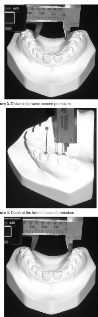 Figure 4. Depth at the level of second premolars 