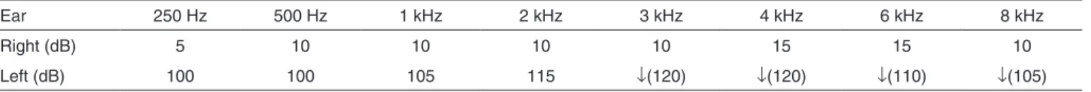 Table 1. Pure-tone air-conduction threshold values of the patient 