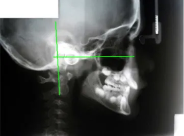 Figure 1. Cephalometric measurements CC1