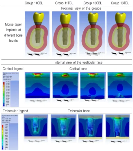 Fig. 2. Groups formed with Morse taper implants at different bone levels and VMES for cortical and trabecular bones