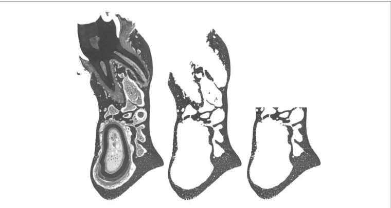 Fig. 4. Cut section vertically aligned. Soft tissue, alveolar process and tooth were removed from the image to measure the area of mandibular basal bone.