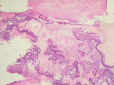 Fig. 6. Disordered arrangement of dentin, cementum and pulp. (Decalcified HE; 20×