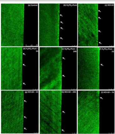Fig. 2: Representative images of the groups obtained from confocal laser scanning microscopy (CLSM).