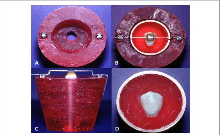 Fig. 1. Mounting fixture used to standardize sample preparation. A. Brackets bonded to the acrylic cup rim; B
