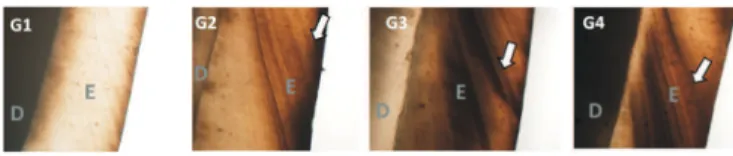 Fig. 1 – Flowchart of the different scores for the dye penetration degree. E – enamel; D – dentin.