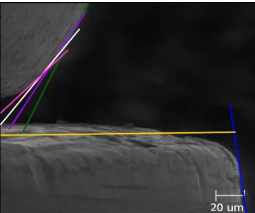 Fig. 4. Implant and abutment profile possibilities that can influence analysis outcome (500x)