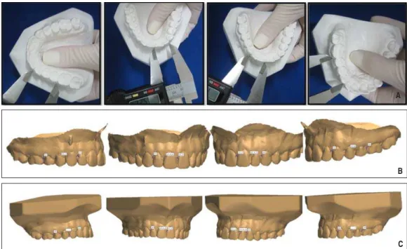Fig. 1. Landmarks and caliper measurements used to determine the arch perimeter on the 3 different model sets: plaster model (A), impression model scan (B) and model scan (C).