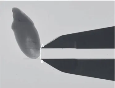 Fig. 2: Root transparency measurement: the maximum length of transparency from the apex on labial surface