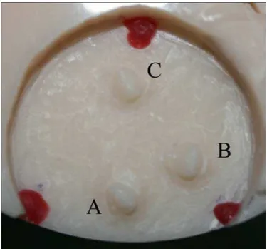 Fig. 1. Acrylic resin matrix used to obtain the addition silicone specimens, where it is possible to observe the three abutments (A, B, C) similar to canine teeth that had their cusp tips sectioned.