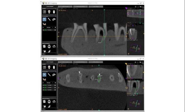 Fig. 2. Computer screen displaying the multidimensional window of software CS 3D Imaging recording the images according to the selected cuts.