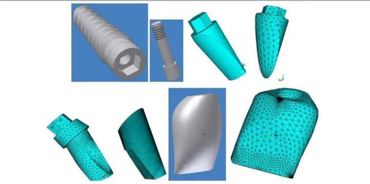 Fig. 1: Modeled and meshed components (implant, screw, GP, abutment, cement layer, crown) screen shots from Inventor / ANSYS screens