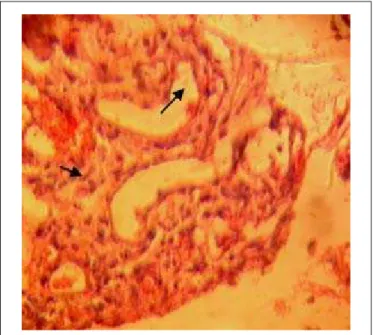 Fig. 1. Granulation tissue formation in Group A. Arrows point to edema and granulation tissue formation