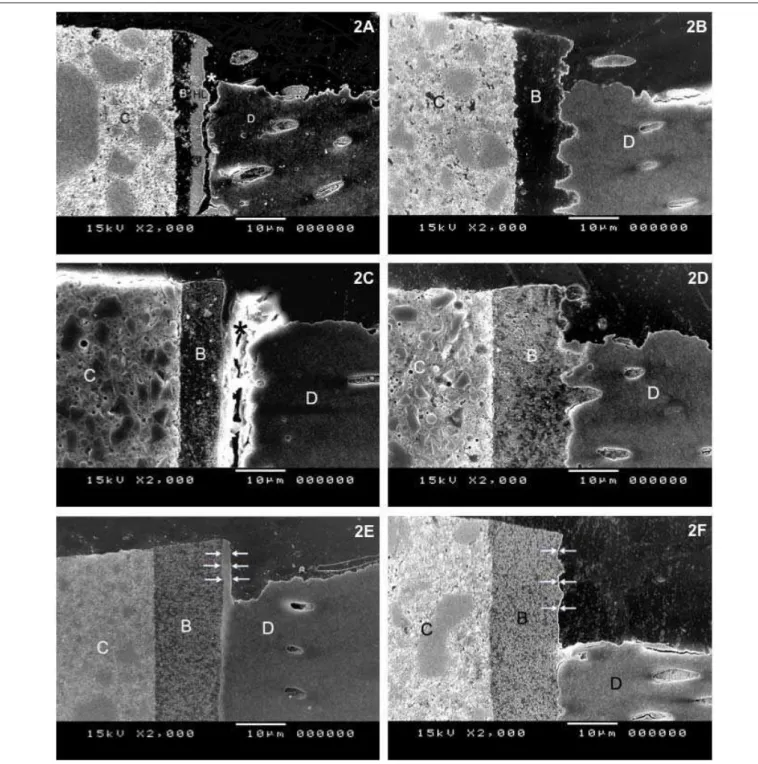 Fig. 2. SEM observations of the adhesive-dentin interfaces after acid-base challenge (x2.000)