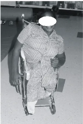 Table 1. Visual Impairments in the General Population and in Individuals with Mental Retardation 35 .
