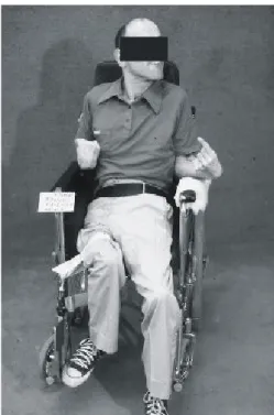 Figure 2. Use of abnormal posturing to access hand held controls.