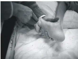 Figure 5. Long standing deformity of foot.