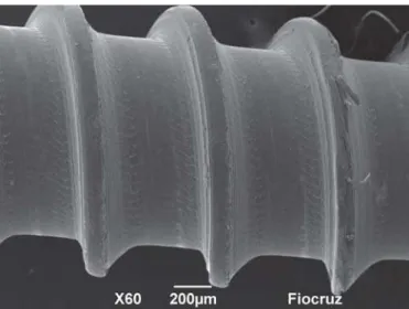 Fig. 3. SEM micrograph of the body of a Morelli ®  mini-implant showing evident surface roughness (x60)